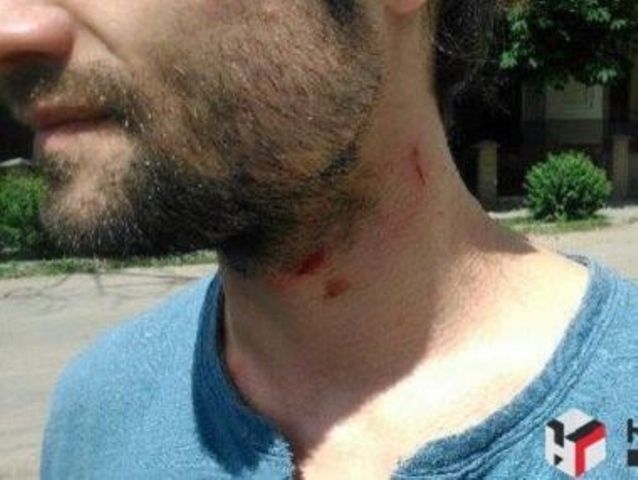 Новость - События - В Харькове напали на киевских журналистов
