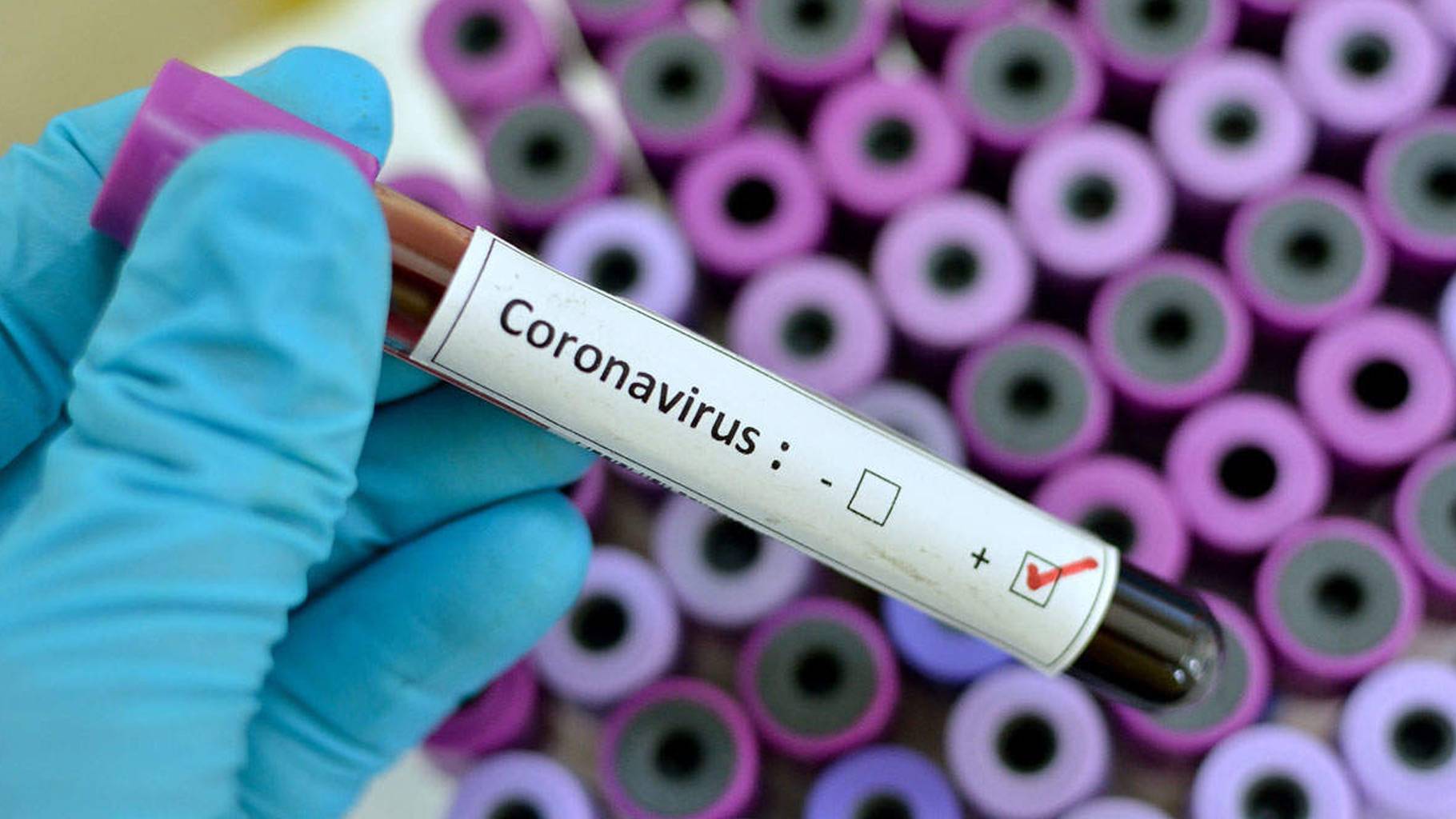 В Украине выявлен первый случай коронавируса. Фото: ichowk.in