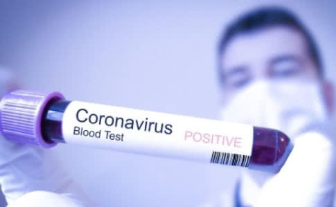 Новость - События - Эпидемия коронавируса: в Черновцах заболели еще двое