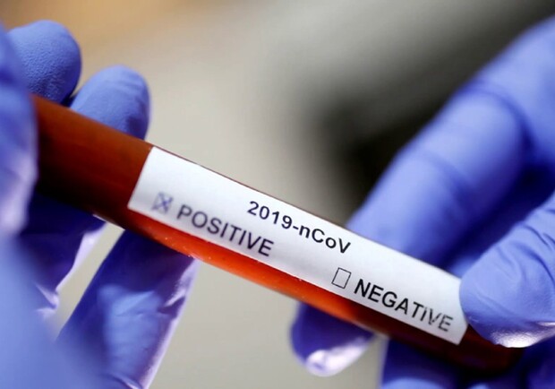 В Харьков закупят 200 000 тестов на коронавирус. Фото: zmist.pl.ua