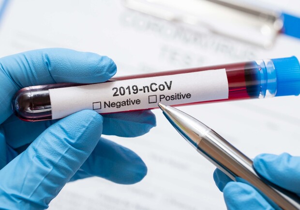 В чем разница между ПЦР и экспресс-тестом на коронавирус. Фото: time24.news