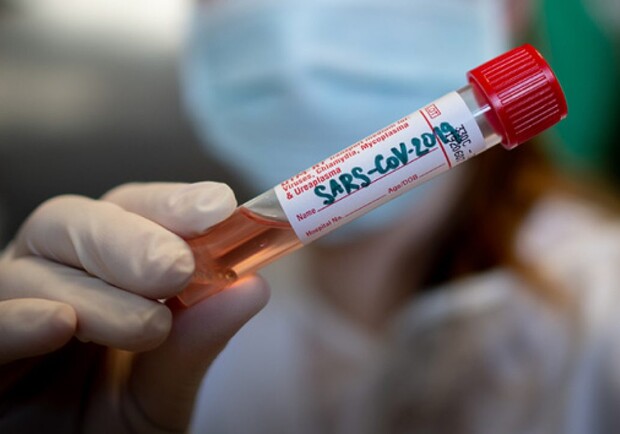 Сколько тестов на коронавирус есть в Харьковской области. Фото: svidok.online
