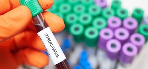 За $850 000: 100 тысяч ПЦР-тестов, купленных Ярославским прибыли в Украину 