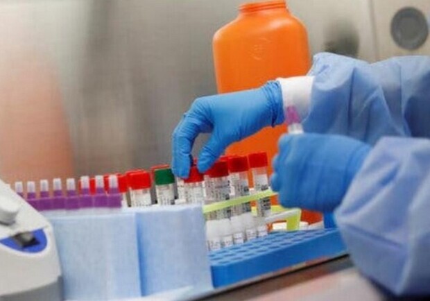Ждут официального подтверждения: в Харьковской области получили 32 полжительных теста на коронавирус фото