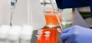 Перевірятимуть на коронавірус: у Львові відкрили третю лабораторію для ПЛР-тестування