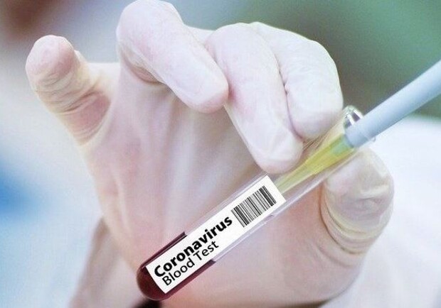 В Харькове бесплатно проверят на коронавирус пациентов и медиков онкоцентра. Фото: interfax.com.ua