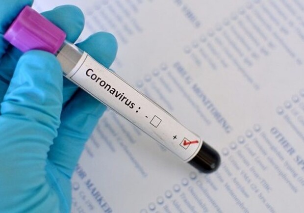 Прошла верификацию: еще одна харьковская лаборатория начала тестировать на коронавирус фото