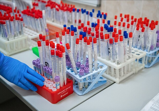 В каких лабораториях Харькова можно сдать тест на коронавирус. Фото иллюстративное: top4man.ru