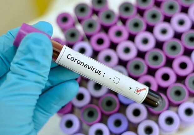 В Харьковской области подтвердили 64 случая коронавируса за сутки. Фото: auc.org.ua