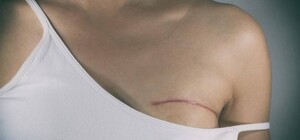 В Одессе женщины могут бесплатно пройти обследование на рак груди: куда обращаться 