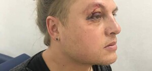 Жесткая конкуренция: в Одессе напали на главного режиссера Оперного театра