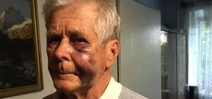 Идет на поправку: как чувствует себя пенсионер, которого избил маршрутчик