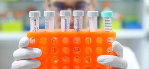 Грозит до 12 лет тюрьмы: в Харькове лаборатория подделывала ПЦР-тесты на коронавирус