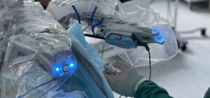 Львівський робот Da Vinci прооперував жінку, яка 30 років страждала на рідкісну недугу 