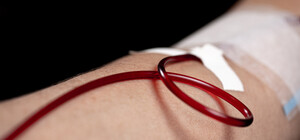 Отдал свою почку: харьковчанку спас от смерти собственный муж