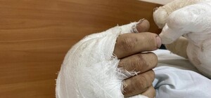 Що відомо про постраждалого львів'янина внаслідок ранкової атаки росіян дронами