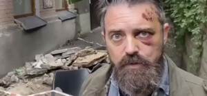 В Киеве американский режиссер вышел на балкон, а тот обрушился