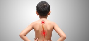 В Одессе детям можно бесплатно обследовать опорно-двигательный аппарат: где и когда