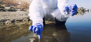 В Днепропетровской области обнаружили холерный вибрион в воде