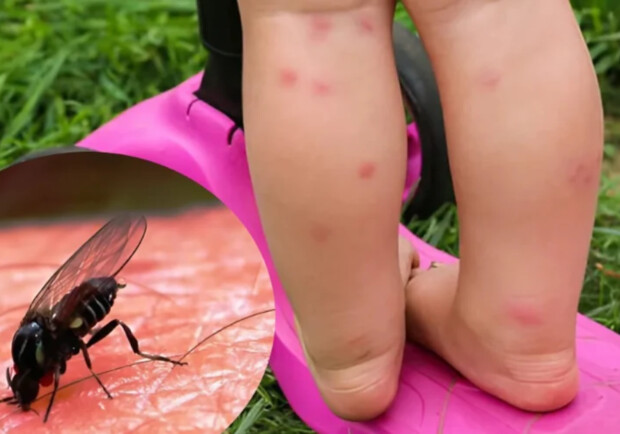 В Днепропетровской области активизировались мокрецы: укусы могут вызвать аллергию