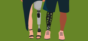 В Харькове впервые провели остеоинтеграционную протезировку для людей с высокими ампутациями