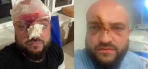 В Одесской области избили ветерана АТО: подробности конфликта