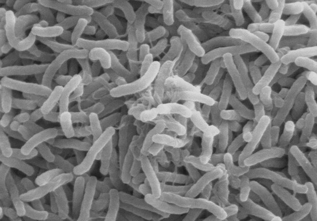 Возбудитель холеры – это холерный вибрион, который практически все время живет в воде. Фото <a href=http://ru.wikipedia.org/wiki/Файл:Cholera_bacteria_SEM.jpg>ru.wikipedia.org</a>.