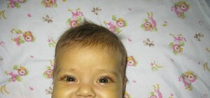 Как удалось собрать миллион на спасение Полинки, почему 