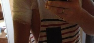 Кривошапко сильно поранился на Канарах