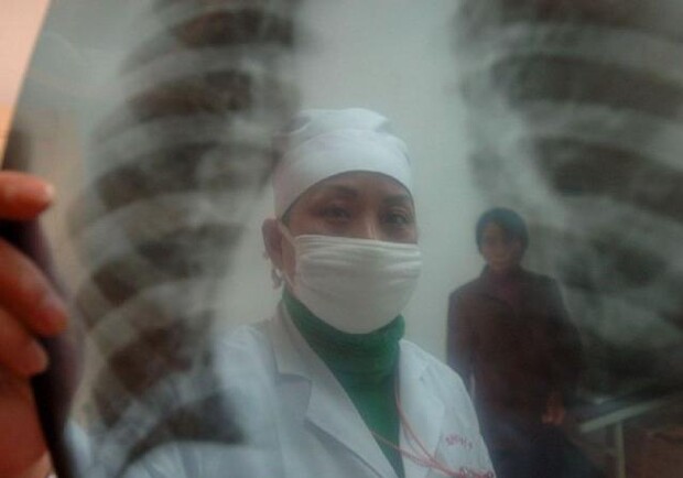 Без надлежащего и своевременного лечения туберкулез приводит к смерти. Фото: vkurse.ua