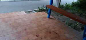 Мэра Феодосии прооперировали, состояние тяжелое