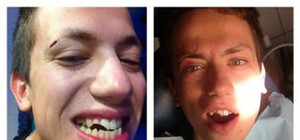 Леше Дурневу дали по лицу в Днепродзержинске?