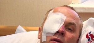 Избиение Шуфрича в Одессе: у МВД 14 подозреваемых