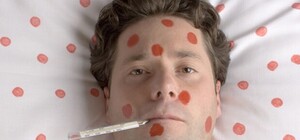 Добрався до Львова: в регіоні вже є захворілі на кір