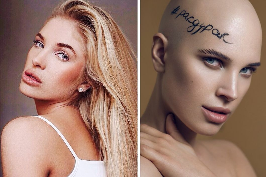 Новость - События - 8 курсов химиотерапии: харьковчанка, победившая рак, будет участвовать в "Мисс Украина 2017"