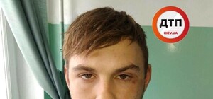 В Киеве ищут родственников избитого парня, который ничего не помнит