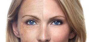 Элос-омоложение, удаление пигментации, лечение угревой болезни со скидкой 20%.