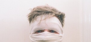 Помстився за кохану: у Львові облили кислотою чоловіка