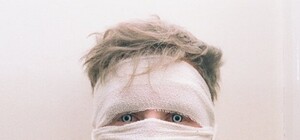 Як покарали: львів’янин плеснув кислотою в обличчя суперника