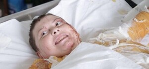 Названа предварительная причина смерти Екатерины Гандзюк