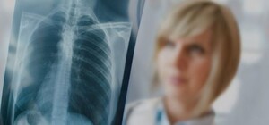 Симферопольцы могут обследоваться на туберкулез: где и когда