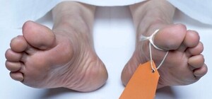 С синяками на голове: на Рогани нашли мертвым пожилого мужчину