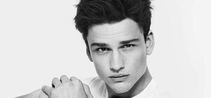 Нужна пластика: парень-модель из Одессы потребовал за ДТП в троллейбусе 20 тысяч долларов