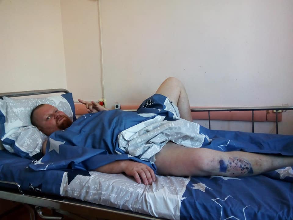 Вадим Макарюк уже месяц находится в больнице. Фото: Анна Черненко