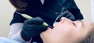 Покажи свою кицю: львівський стоматолог малює картини на зубах пацієнтів