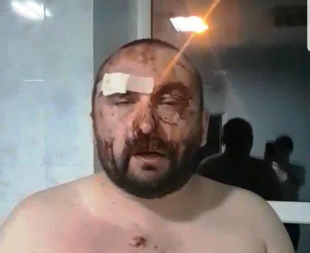 В Харькове напали на адвоката лесхоза. Фото: ХХ