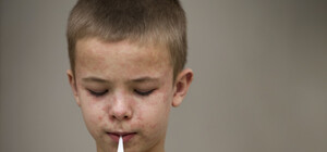 Береги себя: в Запорожскую область вернулась корь