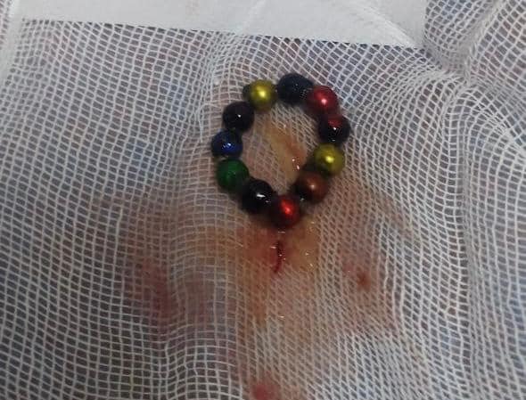 В Харькове годовалый ребенок проглотил 11 магнитов.