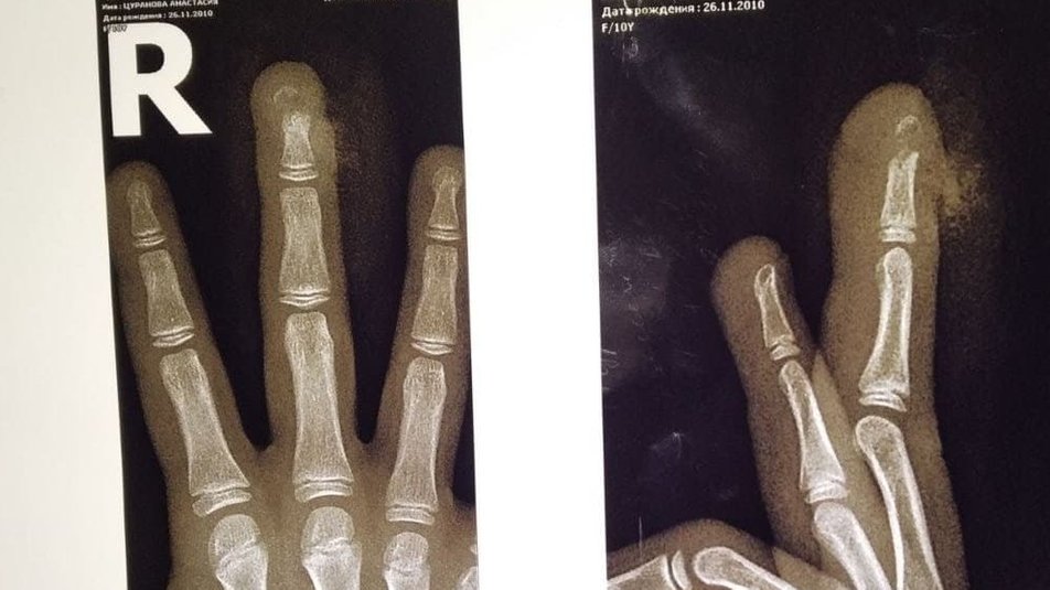 Фото: suspilne.media