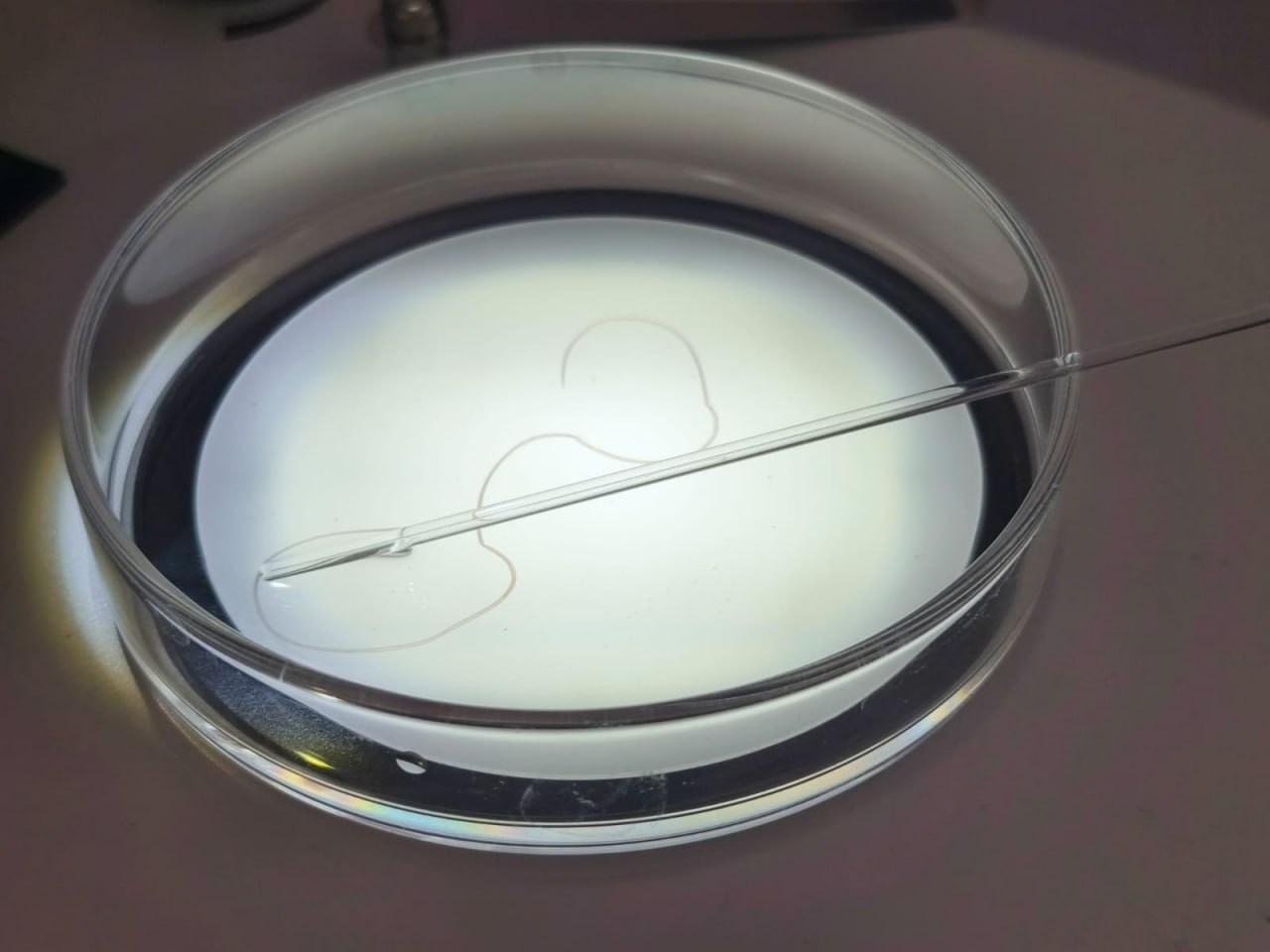 У жительницы Запорожья врачи обнаружили под кожей ужасного паразита.